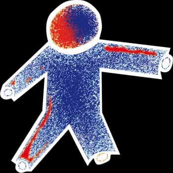 Bundesverband Angeborene Gefäßfehlbildungen e.V. logo